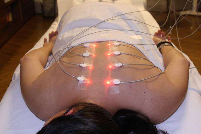 Laser Acupuncture