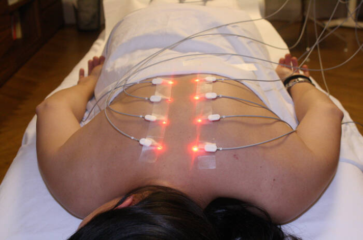 Laser Acupuncture